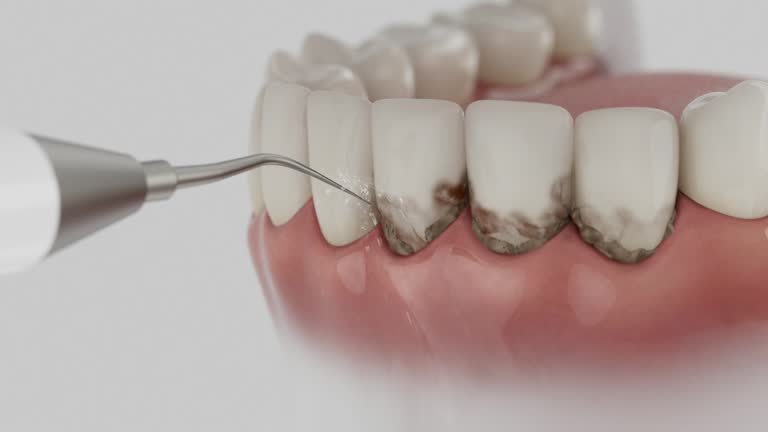 Reliable Emergency Dentist contractor in Ocean View, DE by Smile Center Dentistry